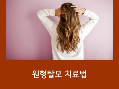 탈모