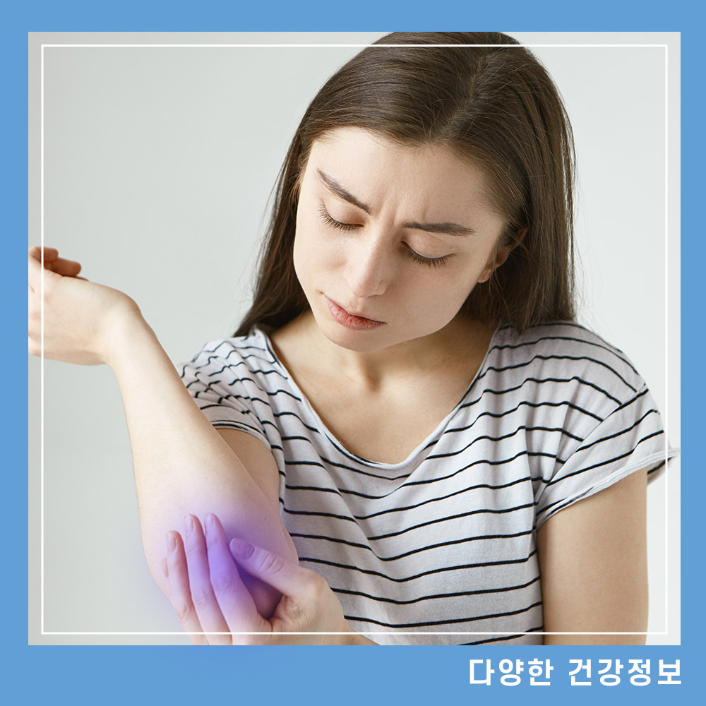 멍드는 이유 멍 연고