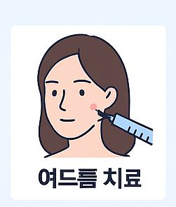 여드름치료 이미지