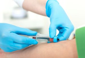 혈액 검사 사진