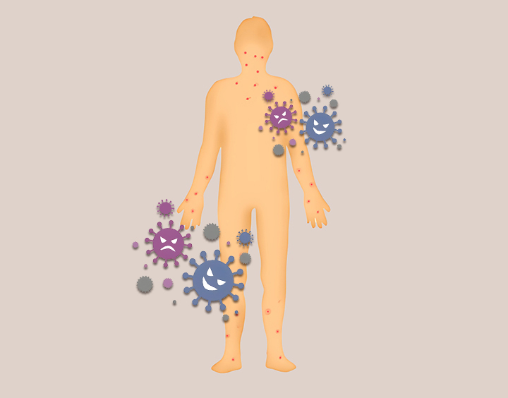 엠폭스가-전신에-퍼지는-모습