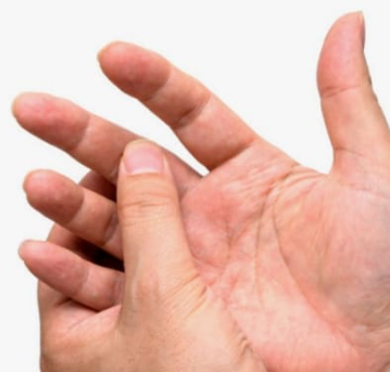 류마티스 관절염 초기증상