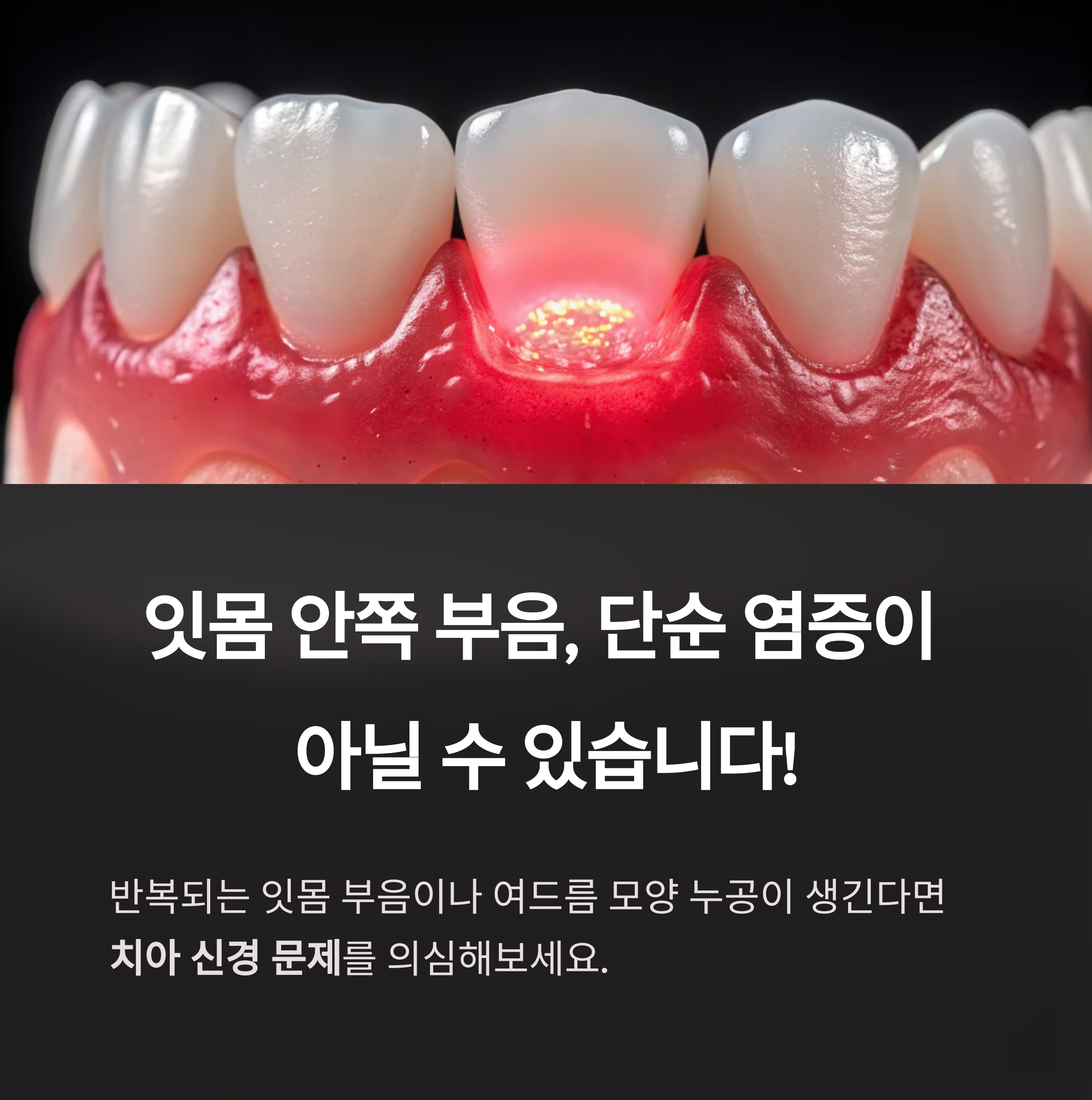 잇몸염증