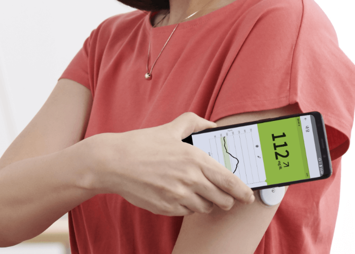 연속 혈당측정기와 무채혈 혈당측정기