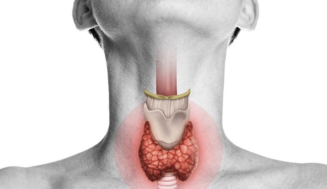 Q&A 갑상선 기능 저하증 증상 원인 진단 치료방법