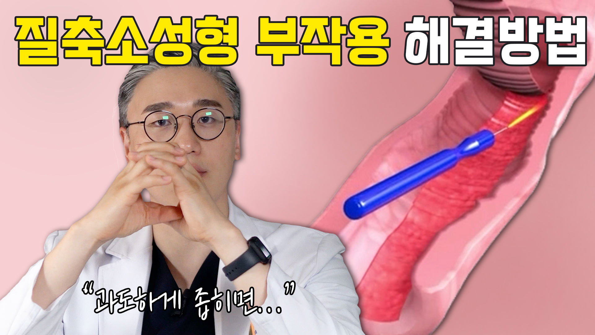 이쁜이수술, 이렇게 하시면 큰일납니다!