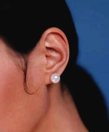 중이염 증상 원인과 치료법, 과연 전염될까?