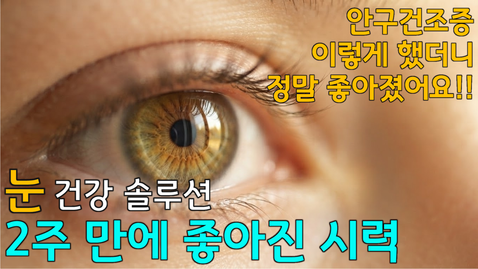 눈 건강 생활 습관 (마이봄샘, 온찜질, 안구건조증)
