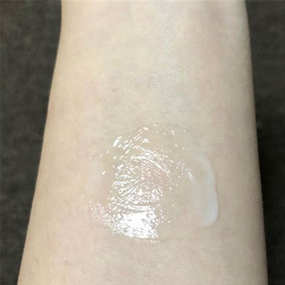 팔 좁쌀 두드러기