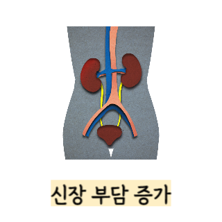 단백질-보충제