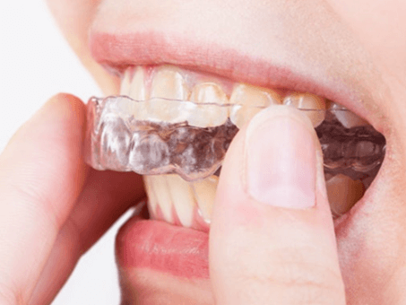 이빨 가는거 고치는법