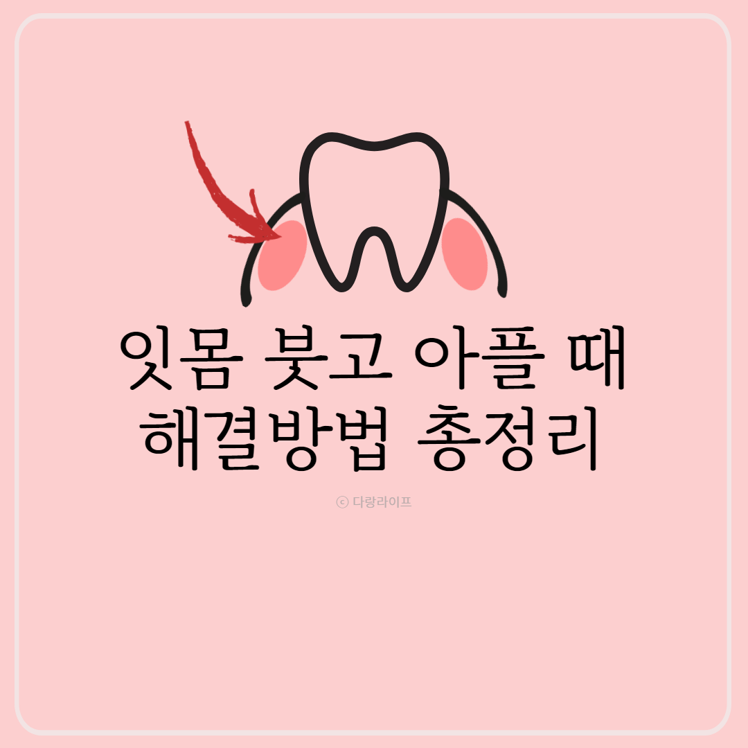 잇몸 부었을 때 잇몸 아플 때 해결방법 총정리