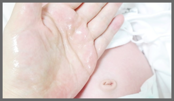 신생아 배앓이 증상 원인