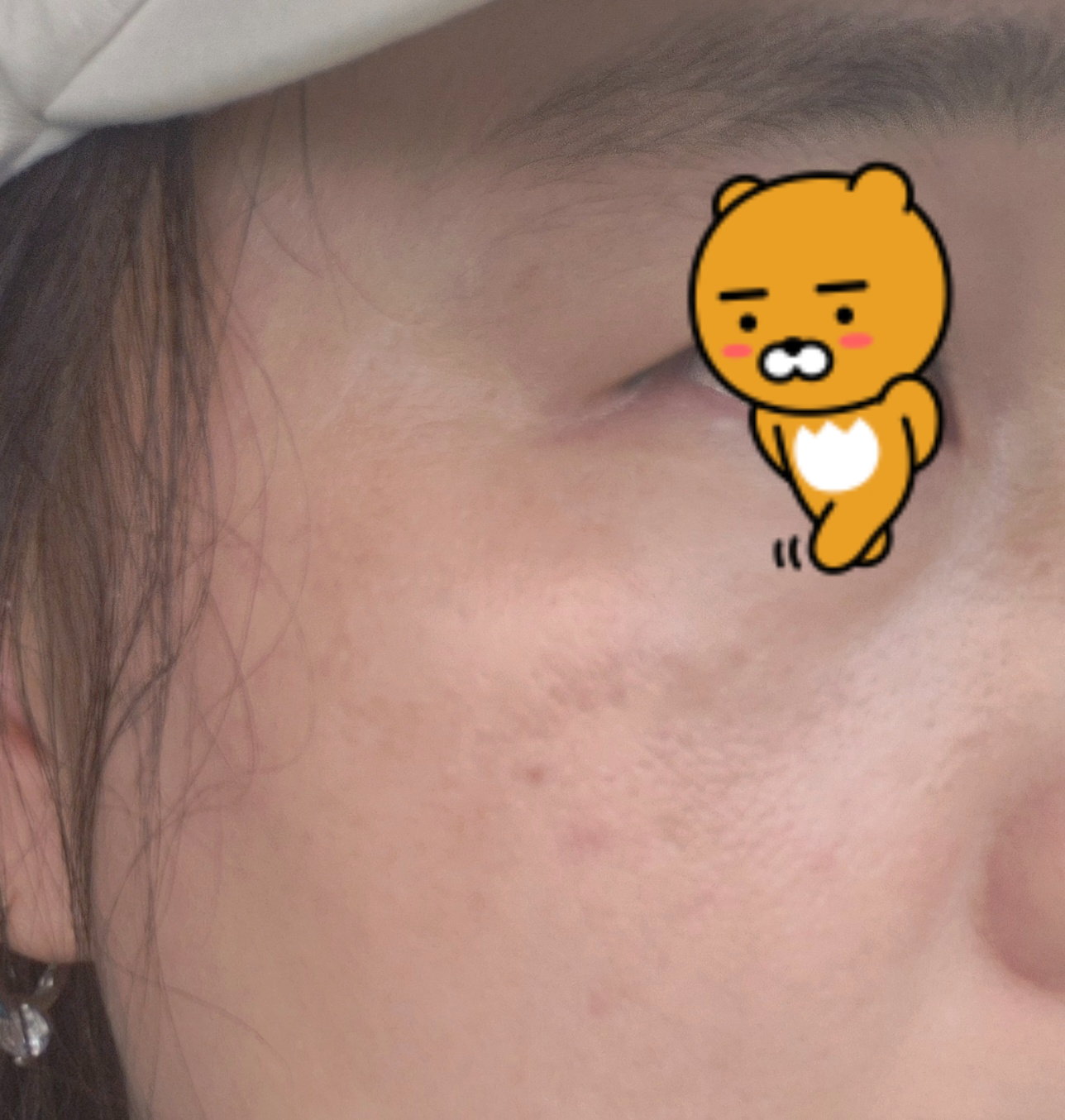 사용후광대기미