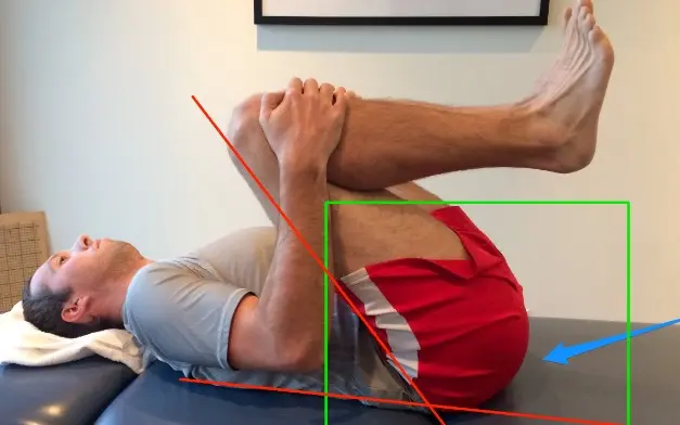요추부 염좌 회복기간 및 스트레칭