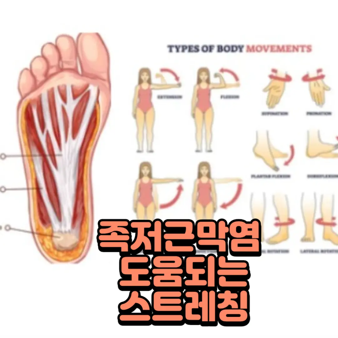 족저근막염 도움되는 스트레칭