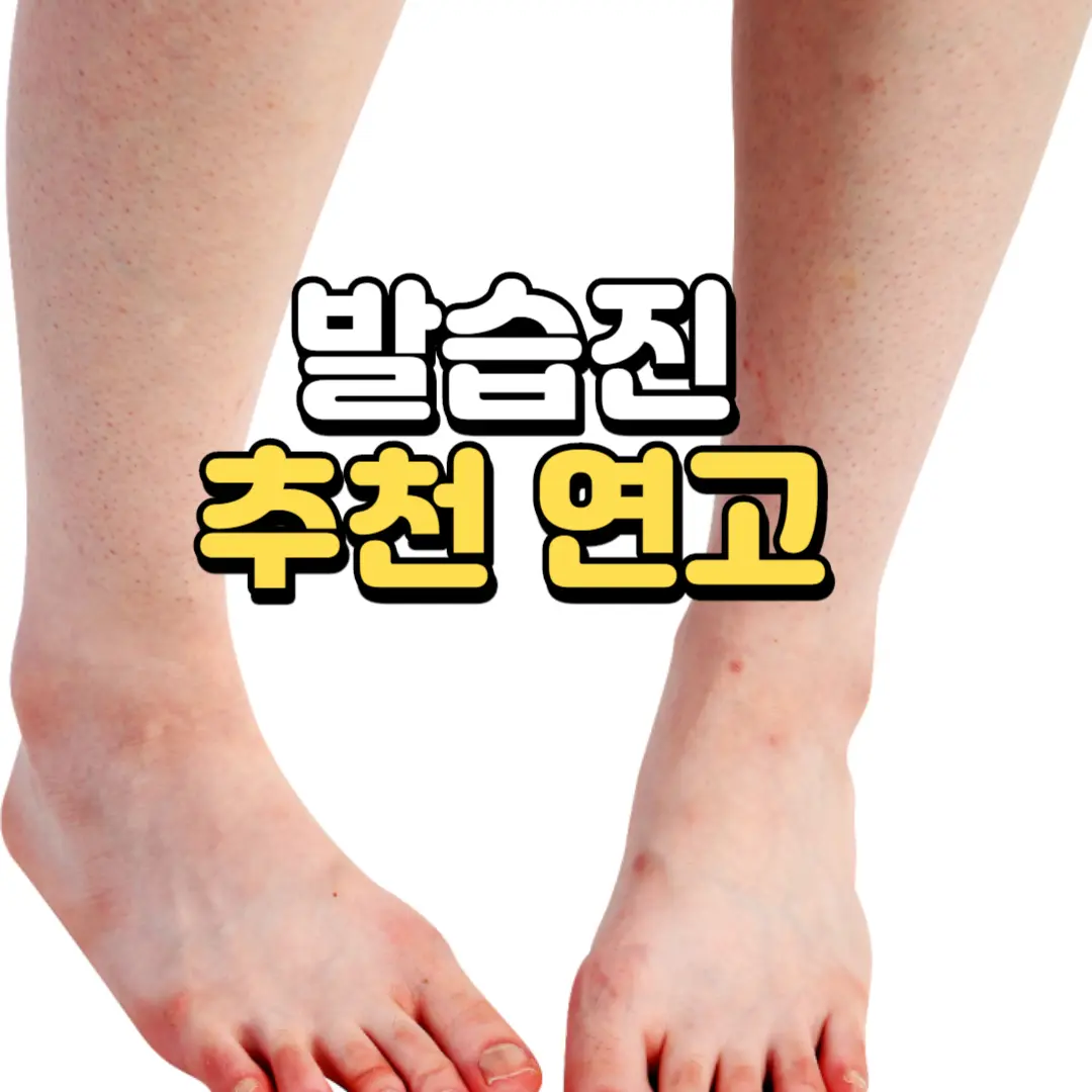 연고치료