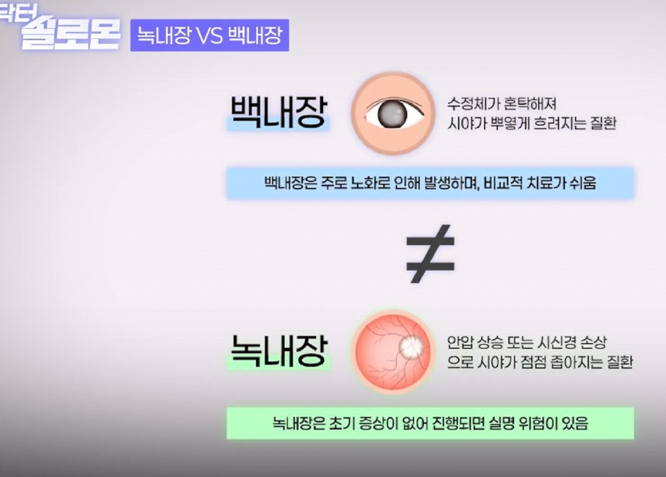 백내장-명의-김민-교수