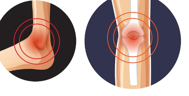 류마티스 관절염의 원인과 증상을 알아보아요