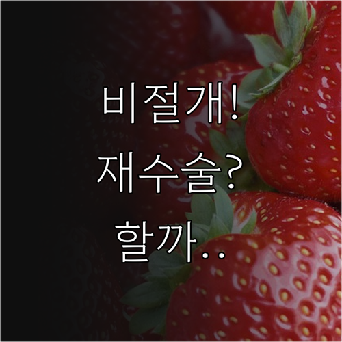 비절개 모발이식 재수술, 받아도 될까..