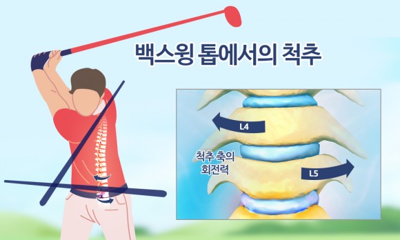 척추와 엘보의 통증