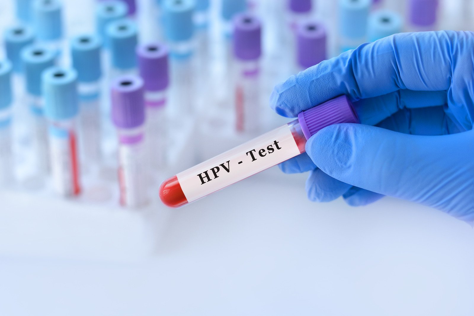 인유두종바이러스(HPV) 감염: 자궁경부암의 주요 원인과 예방 방법