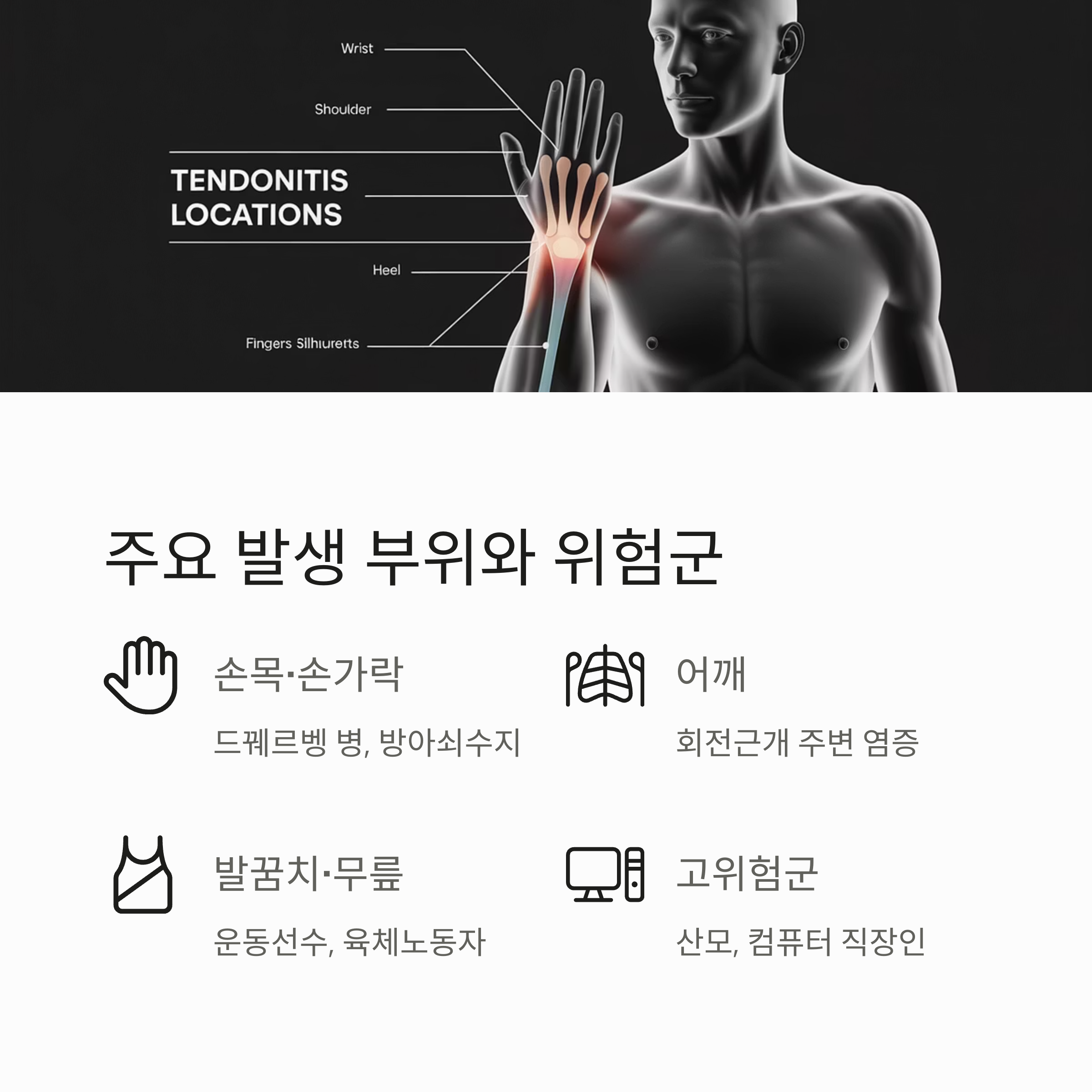 건초염이 자주 발생하는 부위(손목, 어깨, 무릎 등)와 고위험군(산모, 컴퓨터 직장인 등)을 시각적으로 설명한 이미지