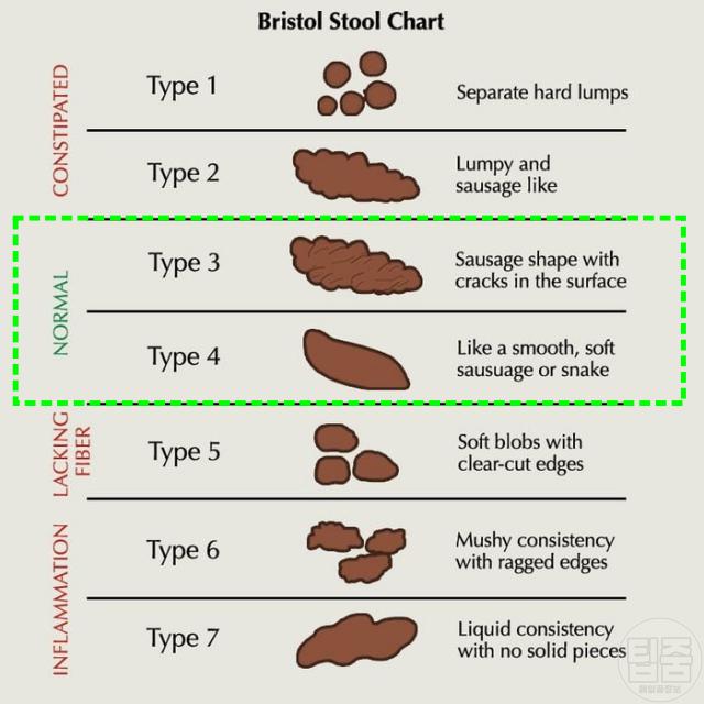 장 건강 장안좋을때가는병원 소화기내과 대변 모양
