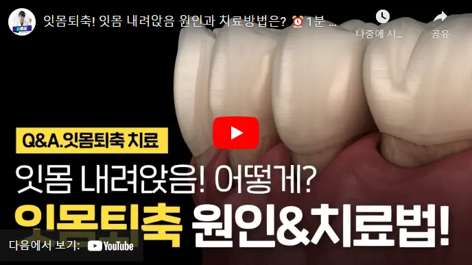 잇몸 퇴축의 원인과 치료법