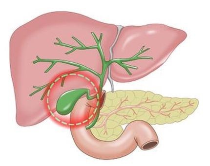 담낭 부위 설명 이미지