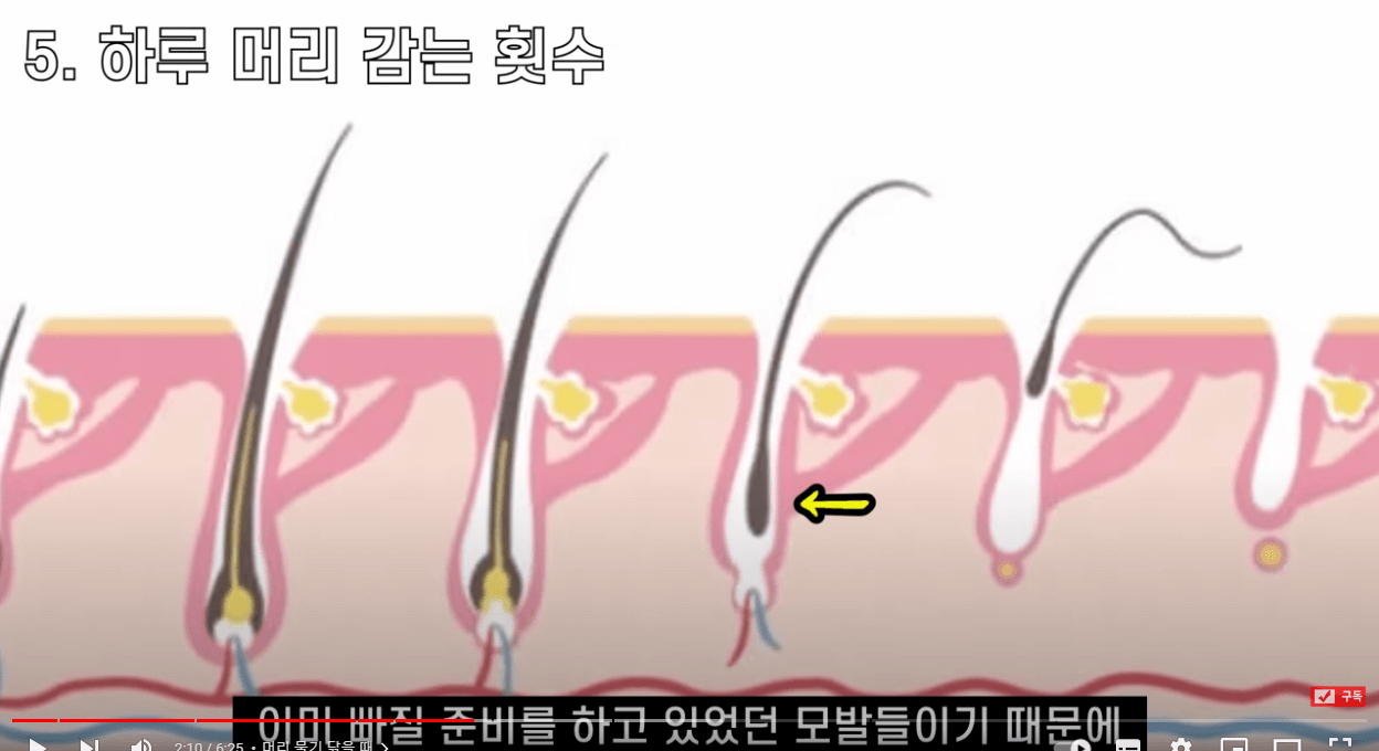 머리 감을 때 절대 하지 말아야 할 행동(9가지)-의사강력추천! ##탈모 #지루성두피염 #머리감기습관 #지루성피부염 #탈모예방 #탈모치료 #두피여드름 #두피뾰루지 #두피건선 #두피가려움 #비듬 #두피각질 #지루성두피염관리 #두피관리 #탈모관리#탈모 #지루성두피염 #머리감기습관 #지루성피부염 #탈모예방 #탈모치료 #두피여드름 #두피뾰루지 #두피건선 #두피가려움 #비듬 #두피각질 #지루성두피염관리 #두피관리 #탈모관리 태그 삭제#탈모탈모 태그 삭제#지루성두피염지루성두피염 태그 삭제#탈모 머리감는 법탈모 머리감는 법 태그 삭제#탈모 머리감기탈모 머리감기 태그 삭제