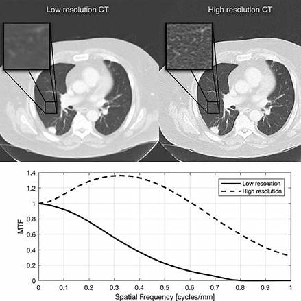 호흡법으로 불안을 줄이는 방법: 패닉 발작 완화 사례 분석