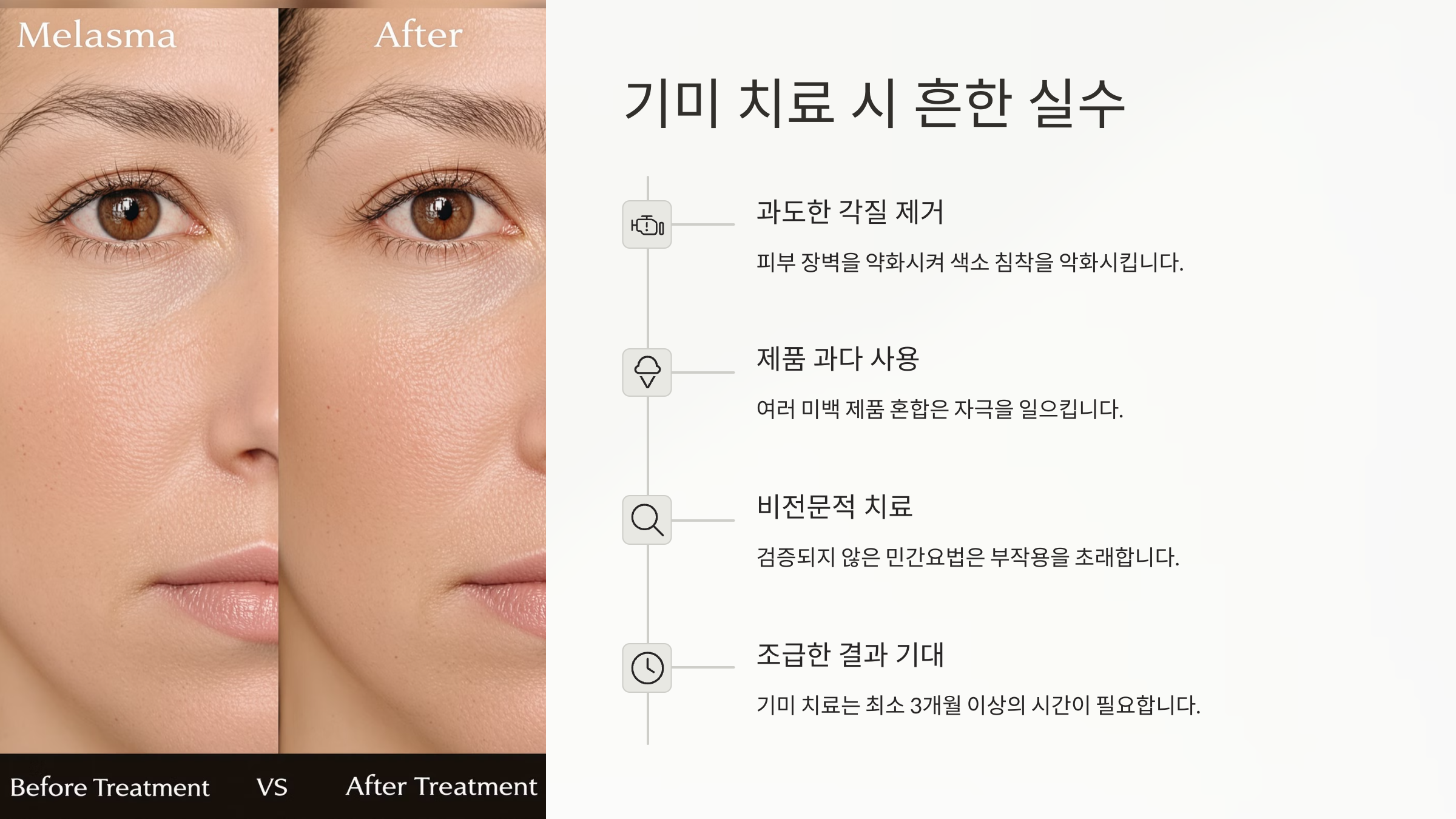 기미치료 완전정복 가이드