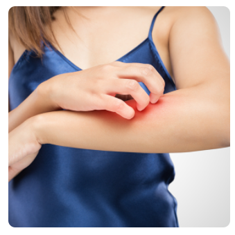 더운 계절 아토피 대책