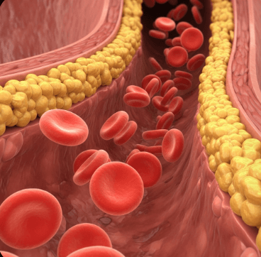 고지혈증 검사 방법 및 치료법3