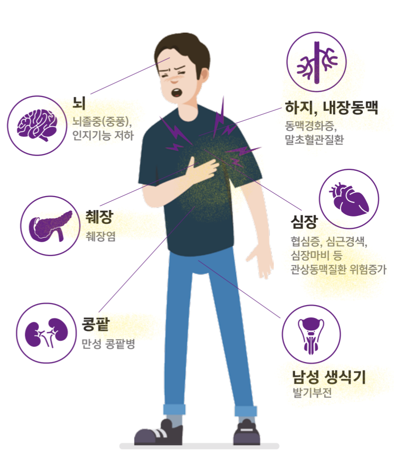 이미지 2
