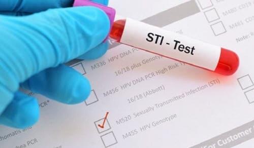 산부인과-STI검사