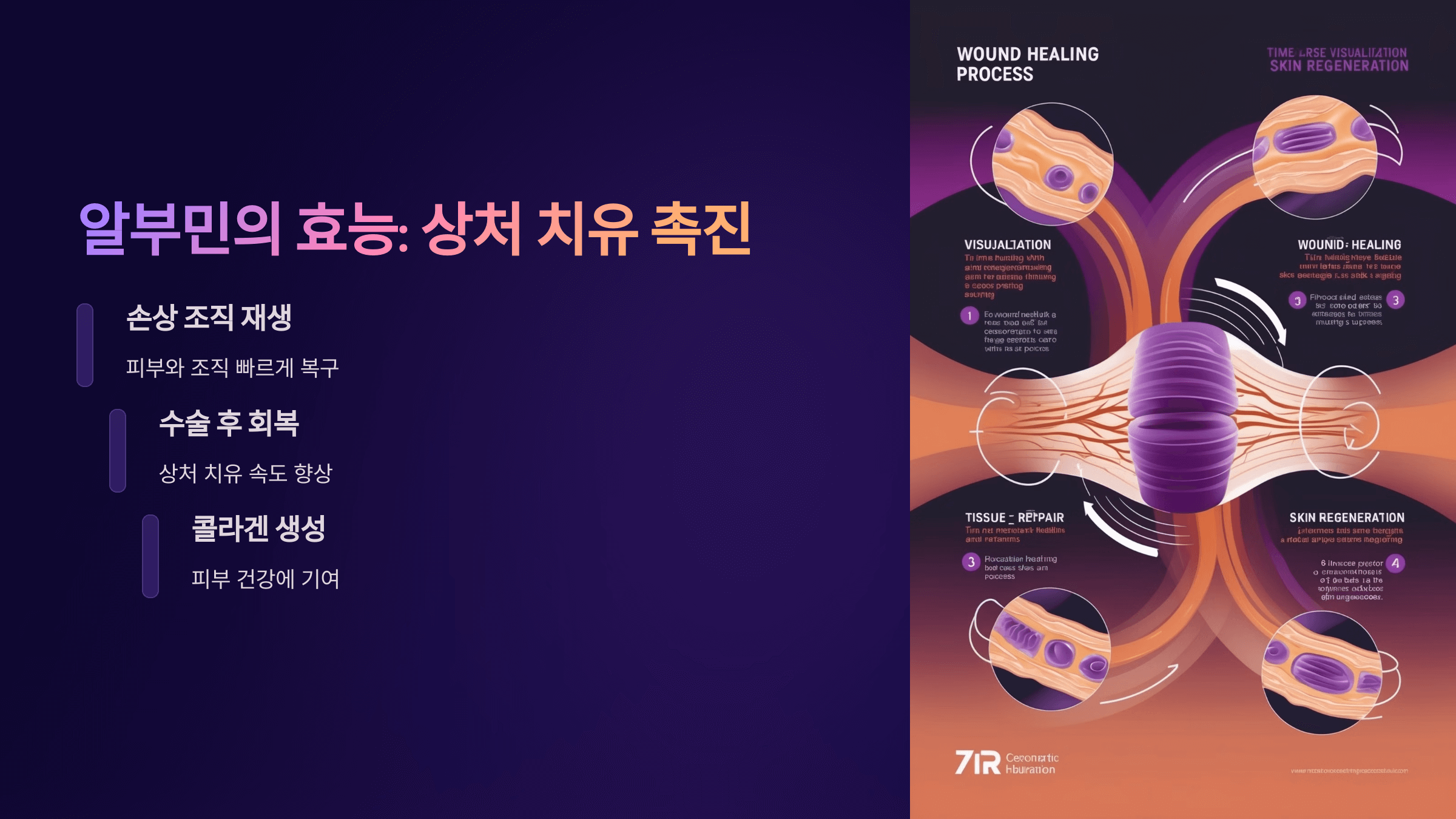 알부민과 관련된 사진입니다.