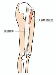 허벅지 통증 원인