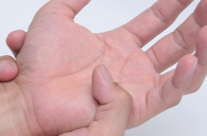 손목터널증후군