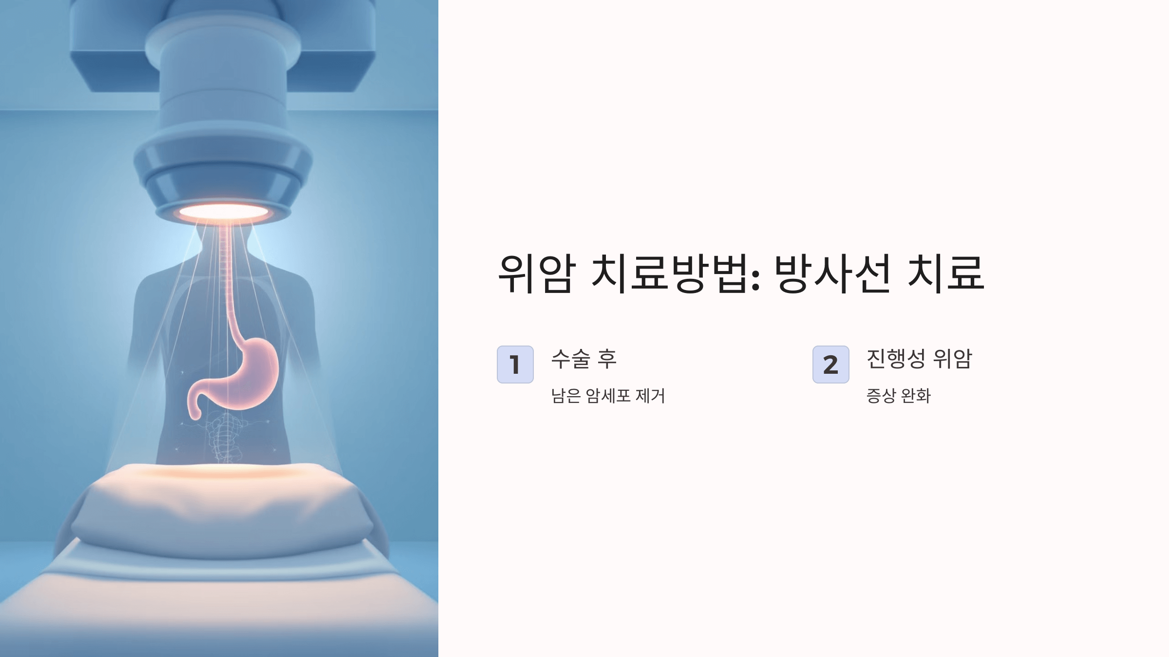 위암과 관련된 사진입니다.