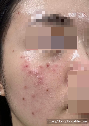 중계의원 기미 리뷰