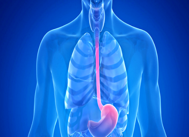 역류성 식도염 원인과 치료법