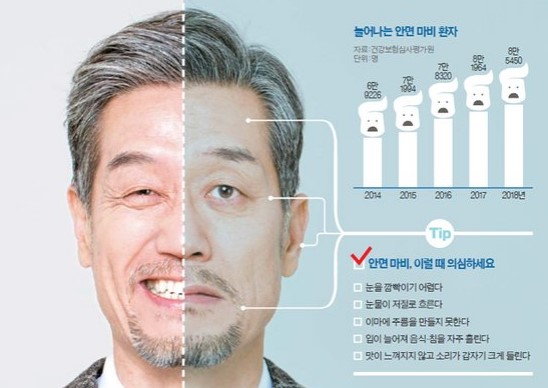 안면마비 전조증상 6가지 및 안면마비 발병 원인과 고치는법 (+ 자주묻는질문)