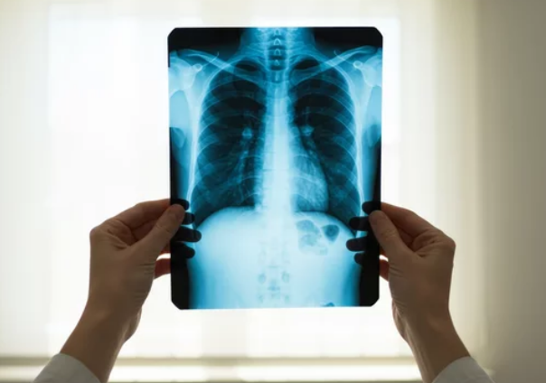 한의사 엑스레이 사용 법안 논란 격화