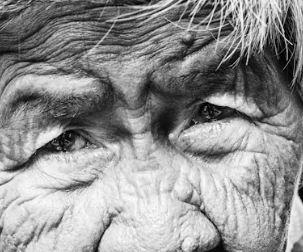 백내장 치료방법 진단 기준 예방법