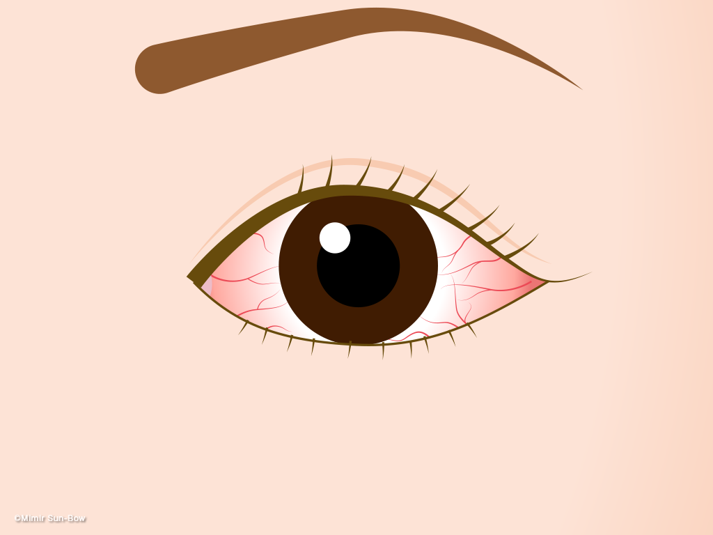 결막염은-4계절내내-발생할수있습니다