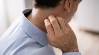 지루성 피부염 증상