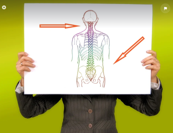 척추디스크 관련 사진