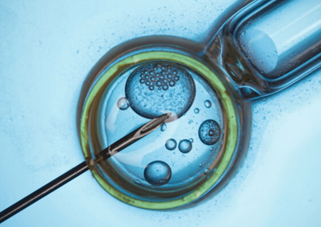 유레아플라즈마